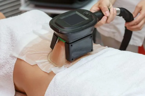 Image of person having fat freezing treatment to help weight gain Birchills